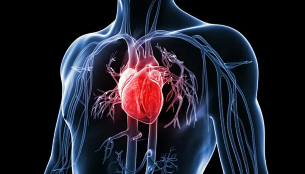 maladies cardio vascularies
